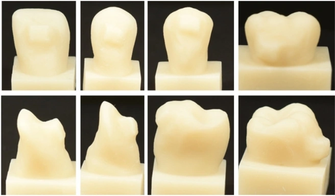 3D-printed Ortho Attachments One-piece vs Two-piece with Provisional Crowns Proof of Concept