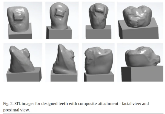 3D-printed Ortho Attachments One-piece vs Two-piece with Provisional Crowns Proof of Concept