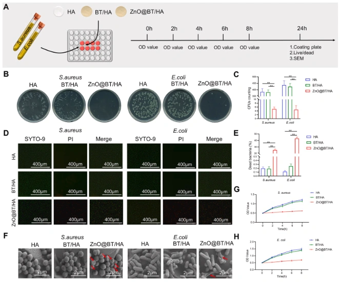 3D-Printed Piezoelectric Ceramic Scaffold: A New Way to Treat Infected Bone Defects