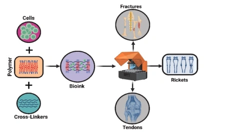Advances in Bone Tissue Engineering: 4D Printing for Dynamic and Adaptive Bone Implants