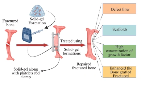 Advances in Bone Tissue Engineering: 4D Printing for Dynamic and Adaptive Bone Implants