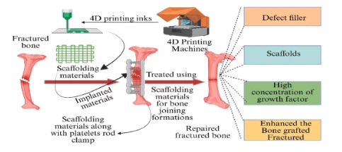Advances in Bone Tissue Engineering: 4D Printing for Dynamic and Adaptive Bone Implants