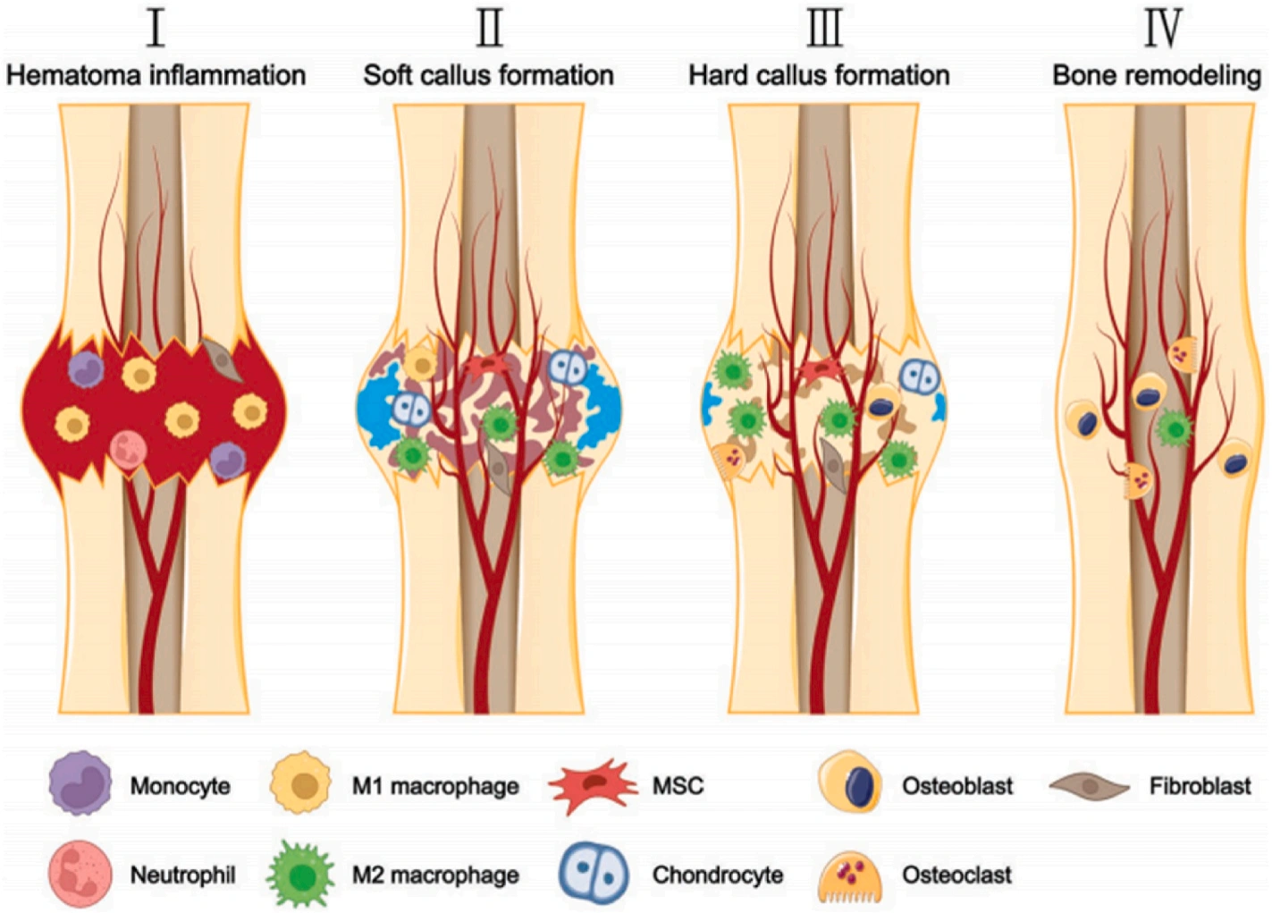 Application and progress of 3D printed bioceramic scaffold in bone tissue repair and immune regulation