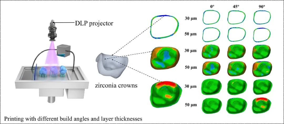 Application of ADT's Light-Curing DLP Ceramic 3D Printer in the Research of Zirconia Dental Crown Printing