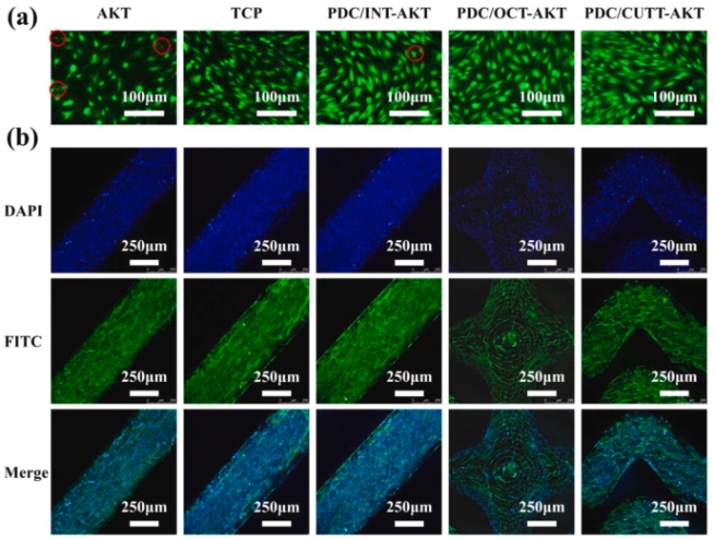 Ceramic 3D printer: How to print polymer-derived ceramic scaffolds with a squid bone-like structure?