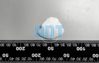 DLP 3D Printing For Functional Bioceramic Structures: From Bone Scaffolds To Customized Implants