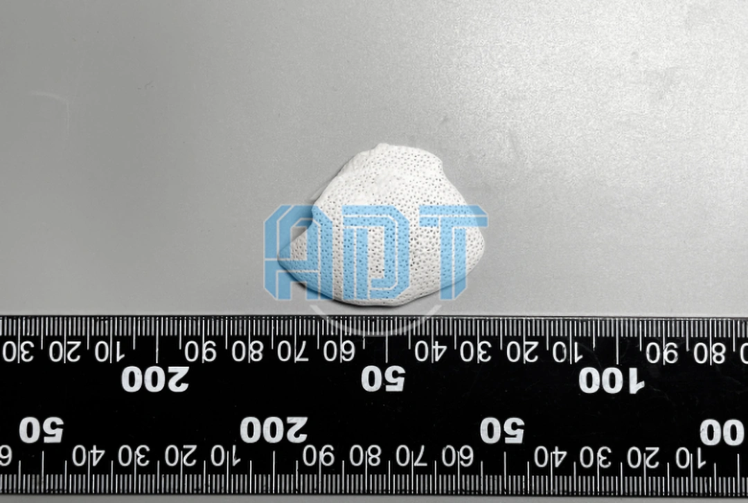 DLP 3D Printing For Functional Bioceramic Structures: From Bone Scaffolds To Customized Implants
