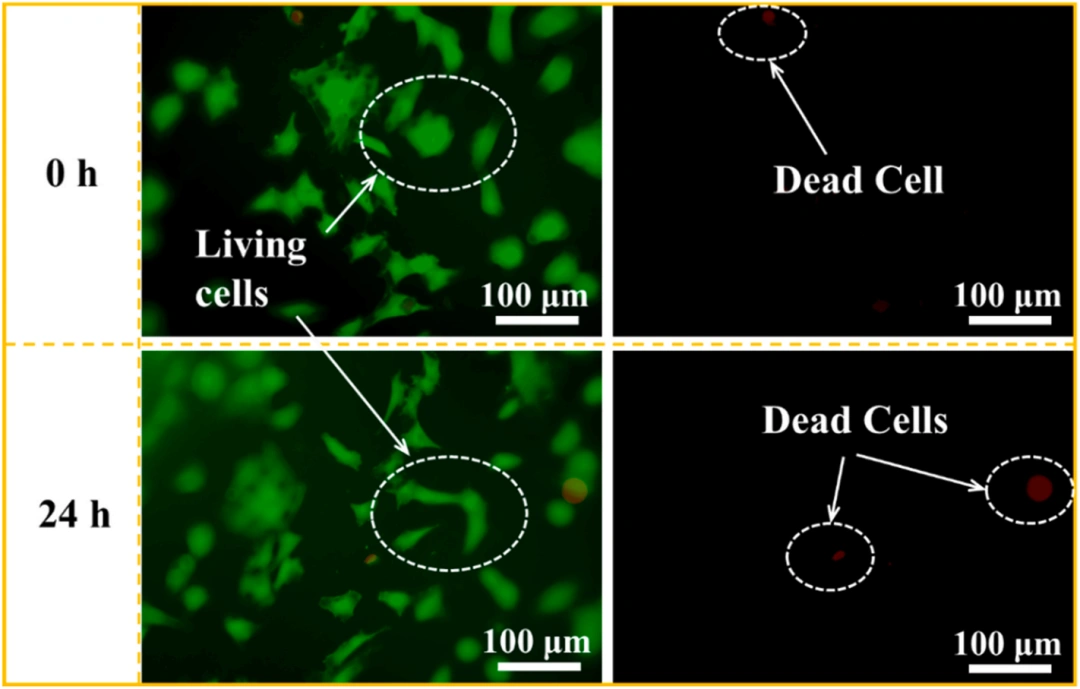 DLP 3D Printing Of SiCN Ceramics With In-Situ SiCN Microspheres: Shrinkage Control, Strength Boost, And Bio-Safety Insights