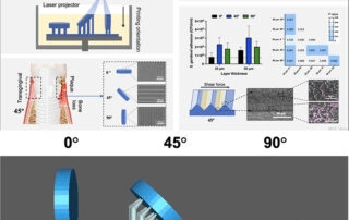 DLP Ceramic 3D Printing: Evaluation Of Microbial Adhesion On Zirconia Surfaces