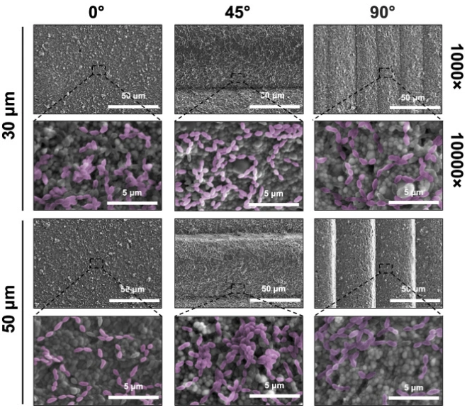 DLP Ceramic 3D Printing: Evaluation Of Microbial Adhesion On Zirconia Surfaces