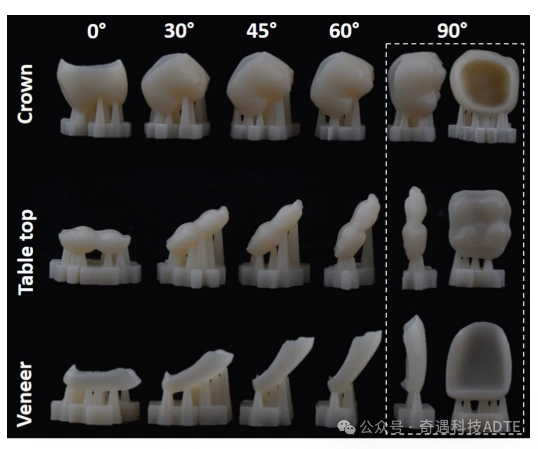 In Vitro Study on the Intaglio Surface Accuracy of 3D-Printed Hybrid Resin-Ceramic Crowns, Veneers, and Onlays