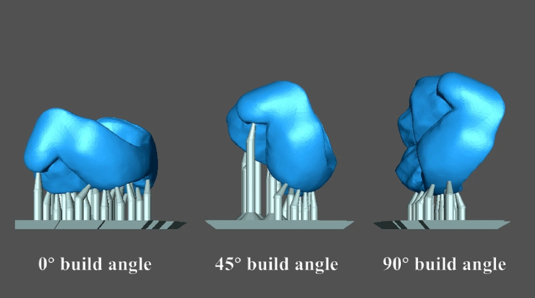 Industry Dynamics丨The influence of build angle and layer thickness on the accuracy of DLP ceramic 3D printed zirconia crowns