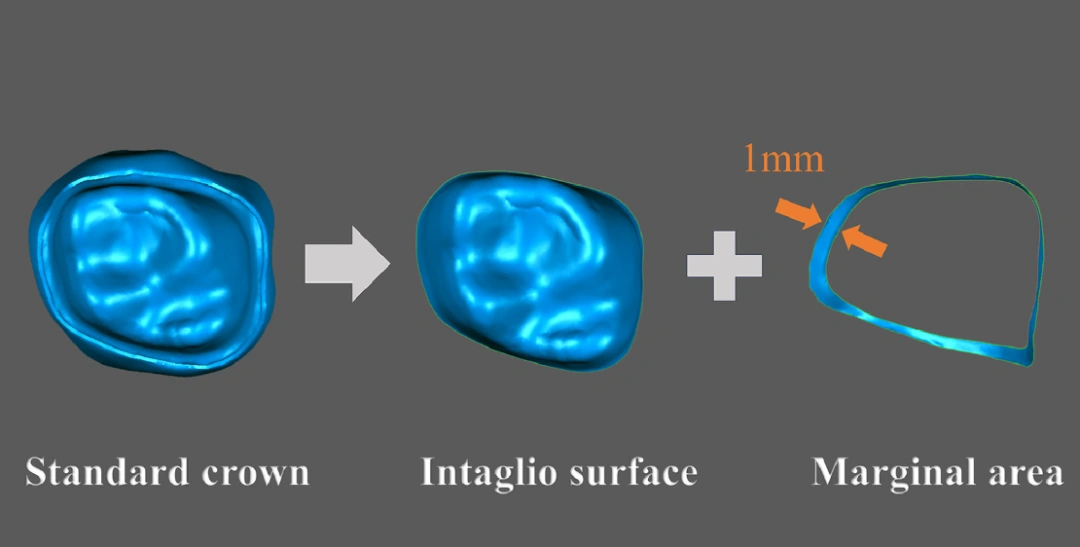 Industry Dynamics丨The influence of build angle and layer thickness on the accuracy of DLP ceramic 3D printed zirconia crowns