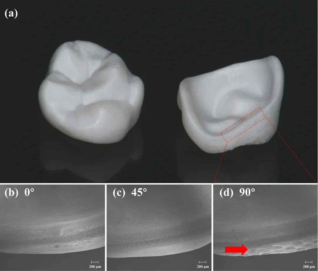 Industry Dynamics丨The influence of build angle and layer thickness on the accuracy of DLP ceramic 3D printed zirconia crowns