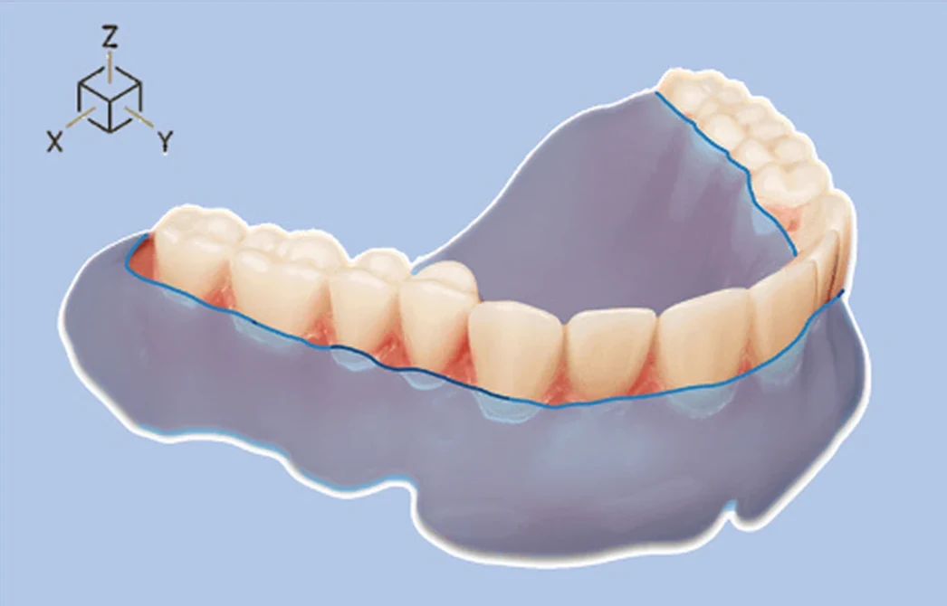 Multi-Material DLP Printing for Dentures: A 2.2× Stronger Tooth–Base Interface