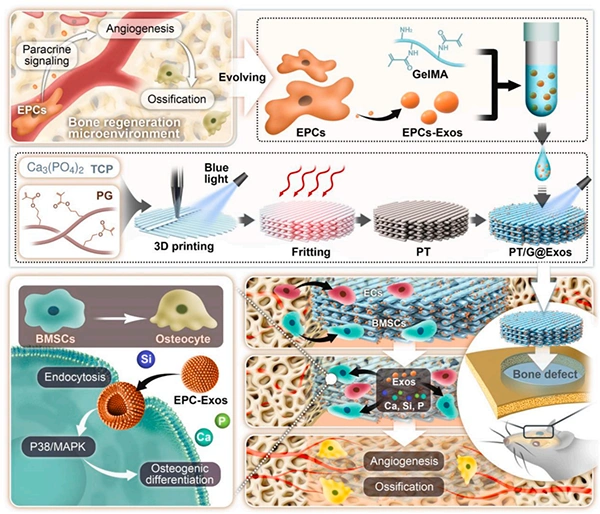 New in the industry. Exosomes give light-curable 3D printed 45S5 ceramic scaffolds to enhance angiogenesis-bone coupling to accelerate bone regeneration.