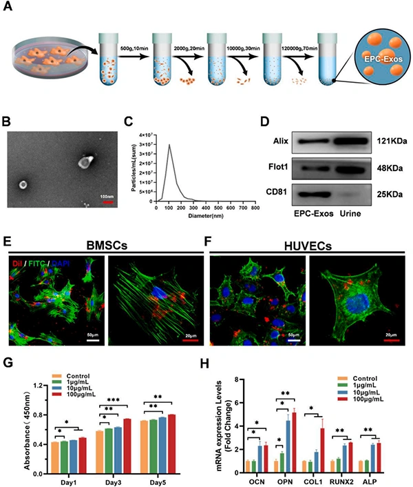 New in the industry. Exosomes give light-curable 3D printed 45S5 ceramic scaffolds to enhance angiogenesis-bone coupling to accelerate bone regeneration.