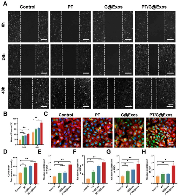 New in the industry. Exosomes give light-curable 3D printed 45S5 ceramic scaffolds to enhance angiogenesis-bone coupling to accelerate bone regeneration.