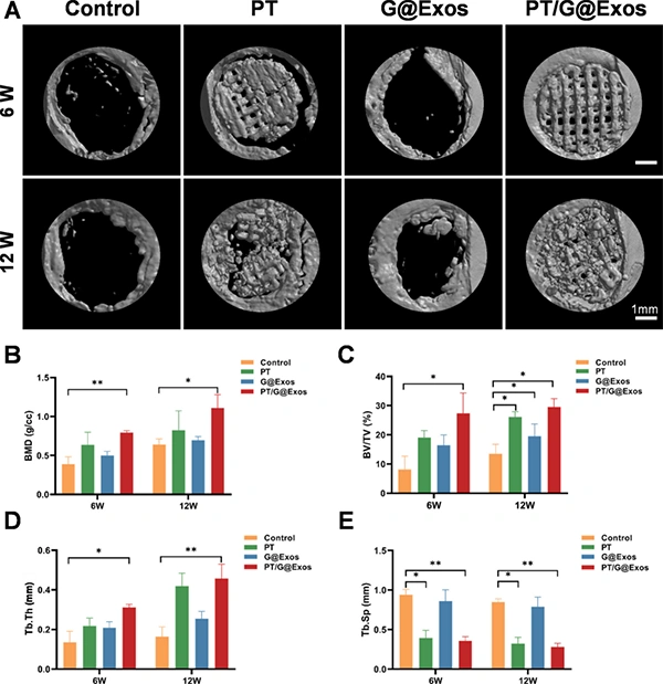 New in the industry. Exosomes give light-curable 3D printed 45S5 ceramic scaffolds to enhance angiogenesis-bone coupling to accelerate bone regeneration.