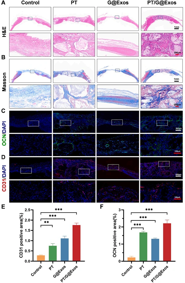 New in the industry. Exosomes give light-curable 3D printed 45S5 ceramic scaffolds to enhance angiogenesis-bone coupling to accelerate bone regeneration.