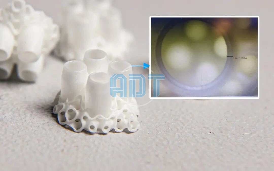 On The Fabrication Of 100 Μm Zirconia Thin-Wall Structures Using A 25 Μm Resolution DLP Ceramic 3D Printing System