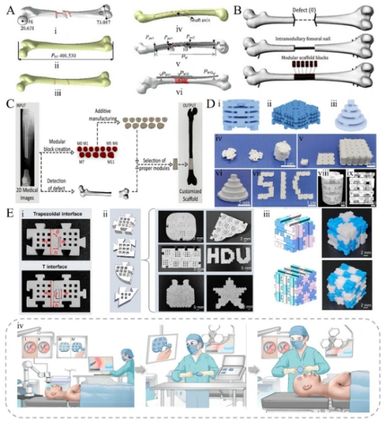 Structural Design of 3D-Printed Bioceramic Scaffolds