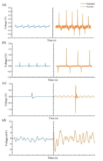 Why Are 3d Print Ceramic Piezoelectric Ceramics With Auxetic Structures Suitable For High-Performance Sensing Devices?