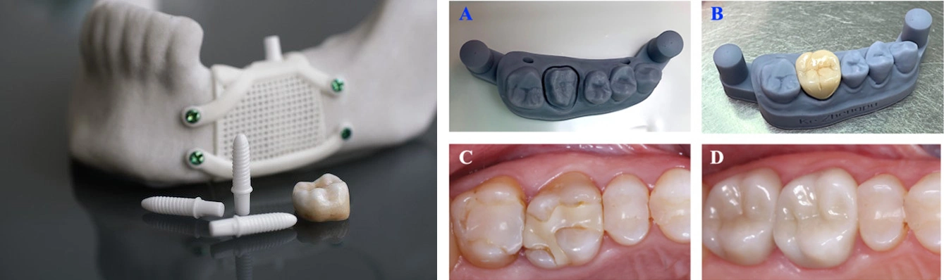 Zirconia 3D Printing With DLP Ceramic 3D Printer: Debinding And Sintering Process Analysis In Light Curing 3D Printing